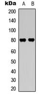 PRKCB / PKC-Beta Antibody (C-Terminus)