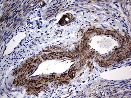 Monoclonal Mouse anti-Human MCAM / CD146 Antibody (clone OTI2G10, IHC, WB)