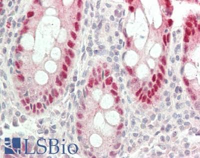 IHC-plus™ RAVER2 Antibody (aa2-691)