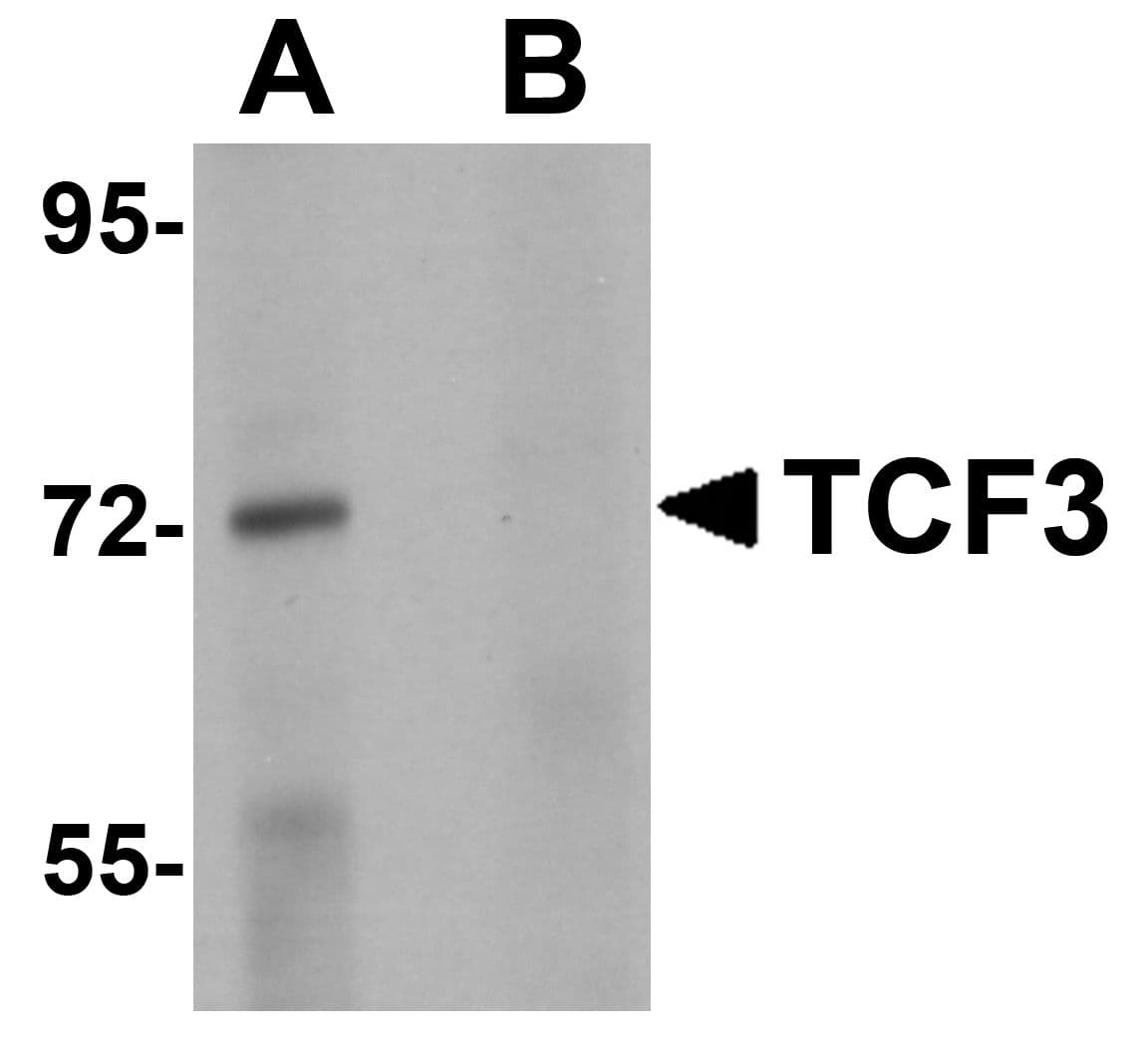 Polyclonal Rabbit anti-Human TCF3 / E2A Antibody (IHC, IF, WB)