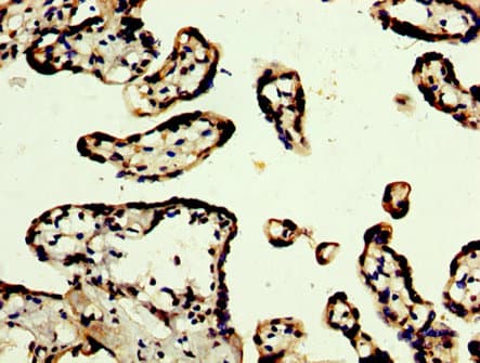PRDM10 / TRIS Antibody