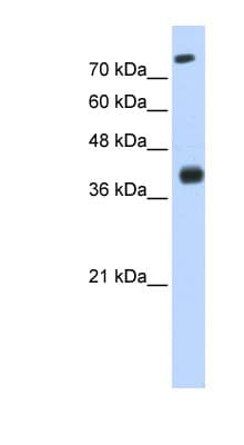 ISL2 / Islet 2 Antibody (N-Terminus)