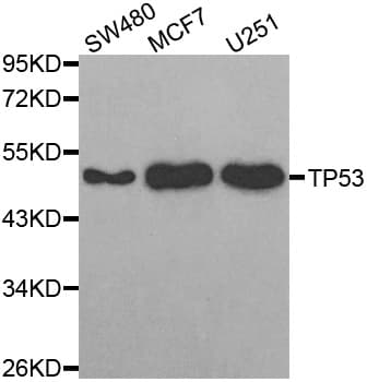 Polyclonal Rabbit anti-Human TP53 / p53 Antibody (IHC, IF, WB)