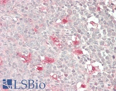 IHC-plus™ CASP3 / Caspase 3 Antibody (clone 5E1)