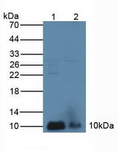 PLA2G2A / SPLA2 Antibody (aa21-144)