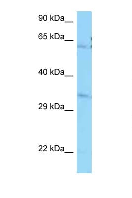 Polyclonal Rabbit anti-Human PPCS Antibody (aa60-109, WB)