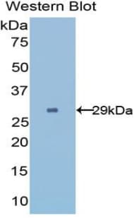 UGGT2 Antibody (aa1221-1408)