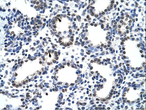 CARS1 / CARS Antibody (aa31-80, HRP)