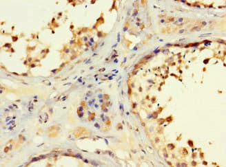 RSPH9 / C6orf206 Antibody