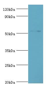 IHC-plus™ GCK / Glucokinase Antibody (aa1-300)