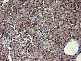 POMC / Proopiomelanocortin Antibody (clone OTI1F3)