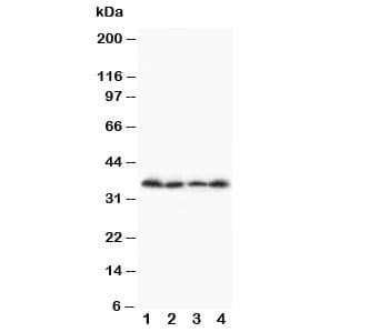 STRA8 Antibody (aa313-330)
