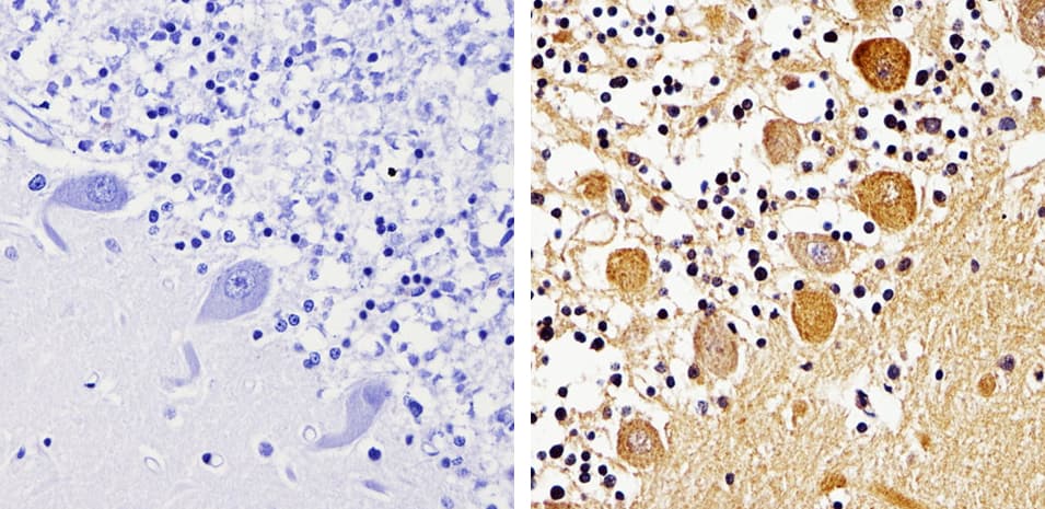 Polyclonal Rabbit anti-Human ARRB1 + ARRB2 Antibody (IHC, WB)