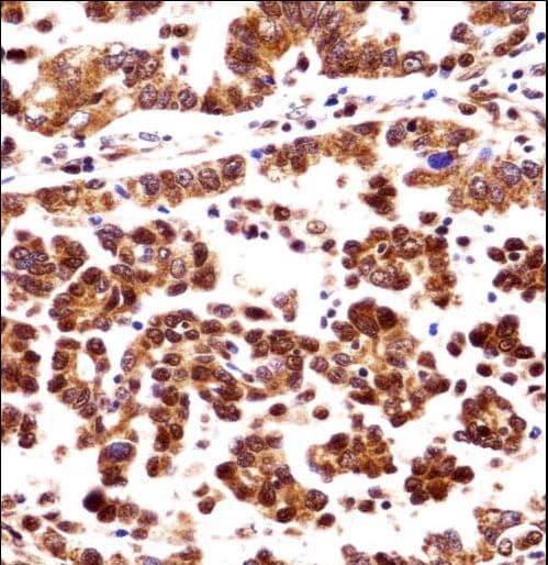 ORC3L / ORC3 Antibody (aa17-46)
