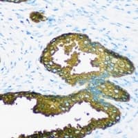 GSTA2 Antibody