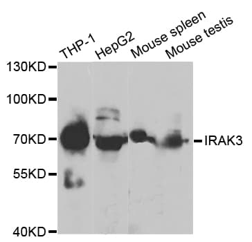 IHC-plus™ IRAK3 / IRAKM / IRAK-M Antibody