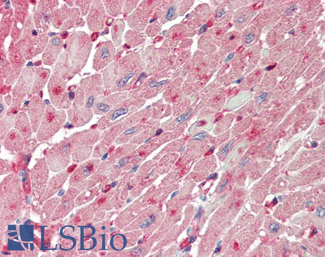 IHC-plus™ Polyclonal Goat anti-Human FABP4 / AP2 Antibody (aa44-57, IHC, WB)
