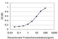 Monoclonal Mouse anti-Human CSNK1G1 / CKI-Gamma 1 Antibody (clone 3D1, IHC, WB)