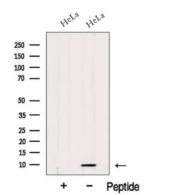 HIGD1A Antibody