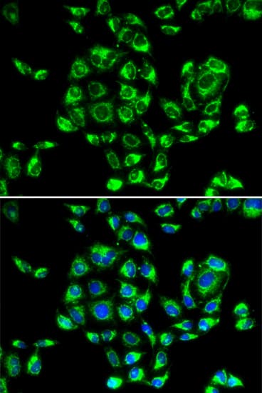 RPS16 / Ribosomal Protein S16 Antibody