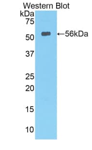 LIPC / Hepatic Lipase Antibody (aa103-356)