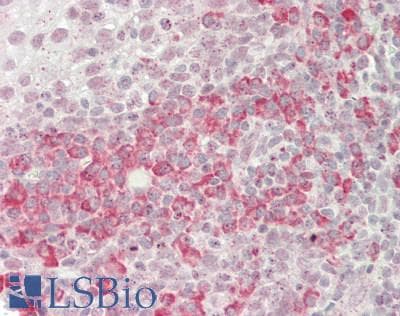 IHC-plus™ NXP2 / MORC3 Antibody (aa634-663)