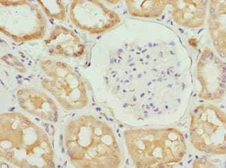 Polyclonal Rabbit anti-Human NANOS3 / NOS-3 Antibody (WB)