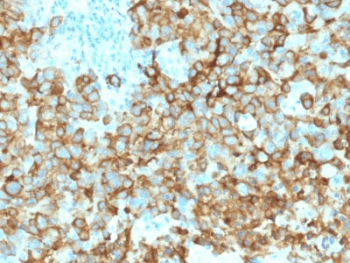 PMEL / SILV / gp100 Antibody (clone PMEL/2039)