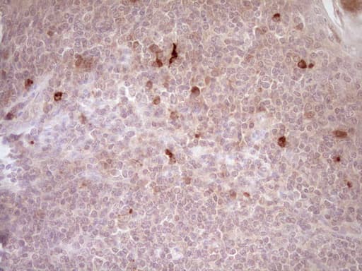 Monoclonal Mouse anti-Human CTGF Antibody (clone OTI2C9, aa27-349, IHC)