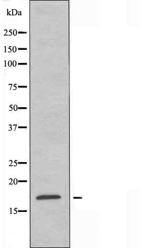 Polyclonal Rabbit anti-Human CST11 Antibody (IF, WB)