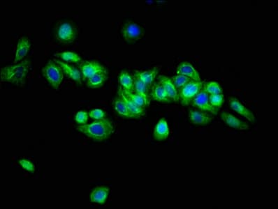 ARSH / Arylsulfatase H Antibody