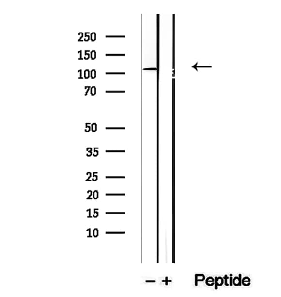 DBN1 / Drebrin Antibody