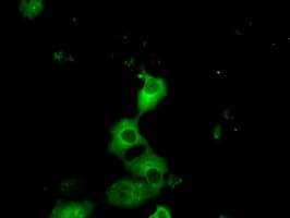 PRKAR2A Antibody (clone OTI1B4)