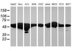 RNF113B Antibody (clone OTI1B10)
