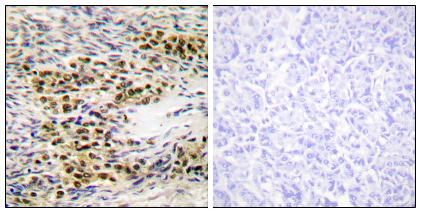 Polyclonal Rabbit anti-Human AKT1 + AKT2 Antibody (aa212-261, IHC, WB)