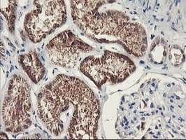 PDSS2 / DLP1 Antibody (clone OTI1D12)