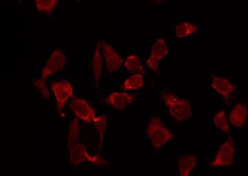 ACTA2 / Smooth Muscle Actin Antibody