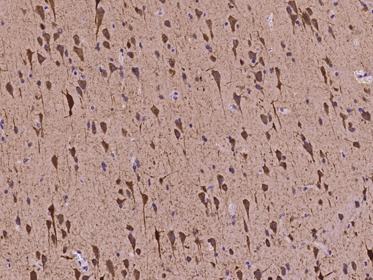 Polyclonal Rabbit anti-Human DLG4 / PSD95 Antibody (IHC, IF)