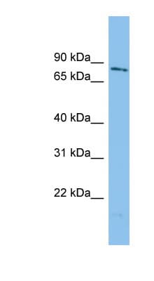 WDR49 Antibody (aa107-156)