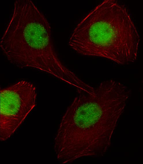 PR / Progesterone Receptor Antibody (aa816-843)