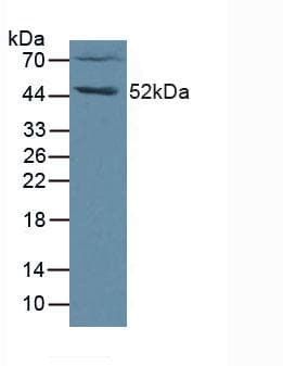 FGL2 Antibody (aa20-432)