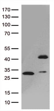 GIPC1 / GIPC Antibody (clone OTI6A6)