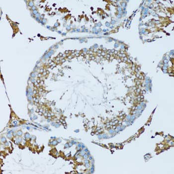 Polyclonal Rabbit anti-Human HPX / Hemopexin Antibody (IHC, IF, WB)