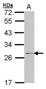 RPL14 / Ribosomal Protein L14 Antibody (aa1-135)