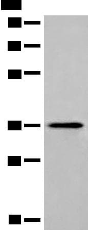 Polyclonal Rabbit anti-Human MLST8 / GBL Antibody (WB)