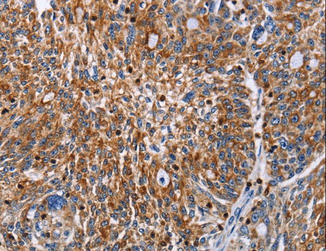 ENPP5 Antibody