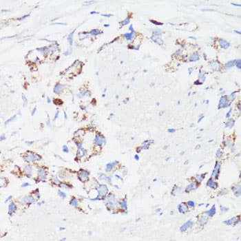 EGFR Antibody