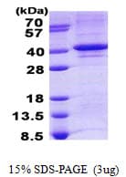 Human TDP1 Protein (Recombinant His)