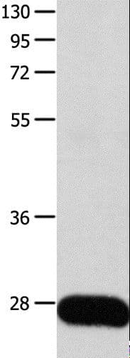 Polyclonal Rabbit anti-Human POMC / Proopiomelanocortin Antibody (IHC, WB)