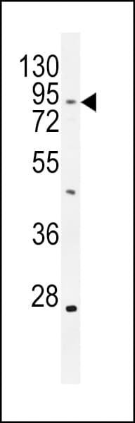 TBC1D14 Antibody (aa259-286)